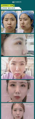 美容专家郭建玲的微博